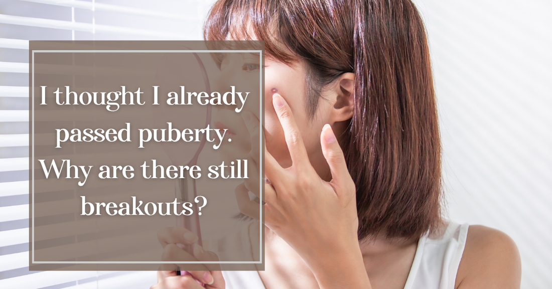 I thought I already passed puberty. Why are there still breakouts?